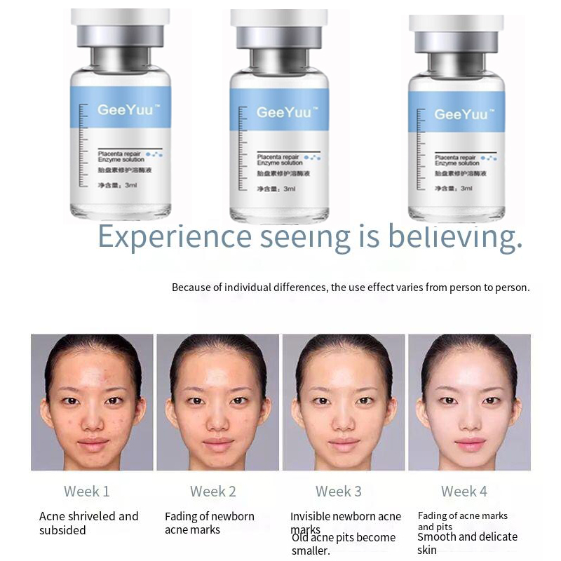 Ampoule de Peptide placent, sé - Placenta Extract Serum avis et prix
